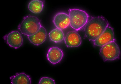 Stelaris RNA Fish in human cells