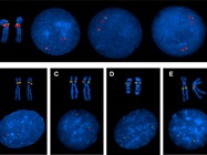 FISH Helps Decipher the Transcriptome