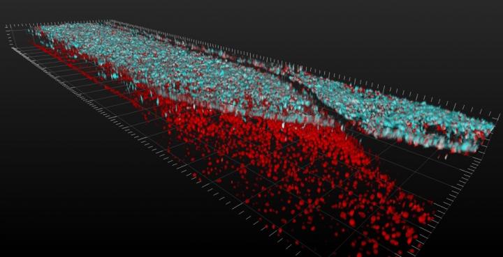 ALS organ chip