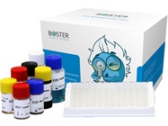 Picokine ELISA Kits