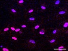 Antibody For Venous Marker
