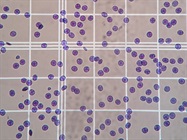Cell Counting, Cancer, and More