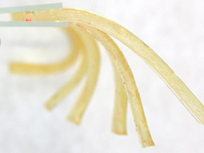 polymer gels