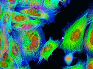 Photobleaching in Live Cell Imaging