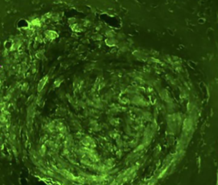blood brain barrier