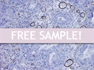 Try our Optibodies! Free sample!