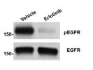 Excellent Antibody To Detect Phosphorylated EGFR In Human Tumor Cells
