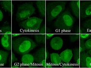 New Ways to Monitor the Cell Cycle