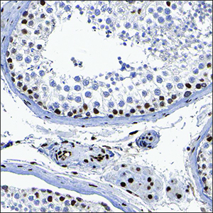ihc staining with anti-atrx