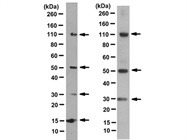 Tips for Choosing Antibodies