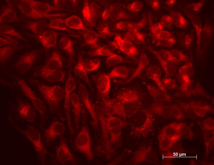 autophagy