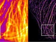Super-Resolution Microscopy Options