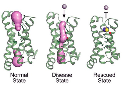 normal, disease, and rescue state voltage sensor