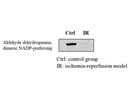 Aldehyde Dehydrogenase Antibody