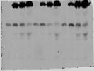 Useful TSG101 Antibody For Western Blot