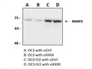MMP2 Antibody for Western Blot