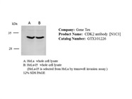 Nice CDK2 Antibody for Western Blot