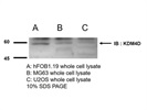 KDM4D Antibody for Western Blot