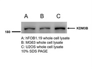 KDM3B Antibody for Western Blot