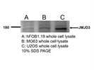 JMJD3 Antibody for Western Blot