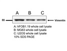 Great Vimentin Antibody for Western Blot
