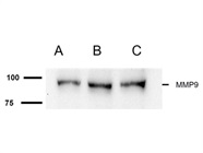 Great MMP9 Antibody for Western Blot