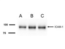 Great ICAM-1 Antibody for Western Blot