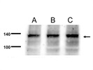 Great CD133 Antibody for Western Blot