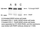 Great PARP Antibody for Western Blot