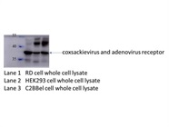 CAR Antibody for Western Blot
