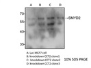 SMYD2 Antibody for Western Blot