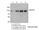 SMYD4 Antibody for Western Blot