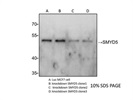 SMYD5 Antibody for Western Blot