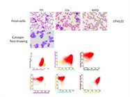Standardized 8-color EuroFlow Protocols and the Impact on Diagnostic Accuracy of Acute Leukemias