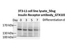 Insulin Receptor Antibody for Western Blot