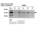 ALDH2 Antibody for Western Blot
