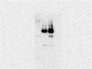 Average Rb Antibody