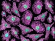 Infographic: Tips and Trends for Live Cell Imaging