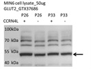 GLUT2 Antibody for Western Blot