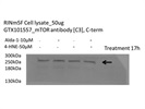 mTOR Antibody for Western Blot