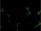 HSD3B2 Antibody for Immunofluorescence