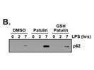 P62/SQSTM1 Antibody for Western Blot