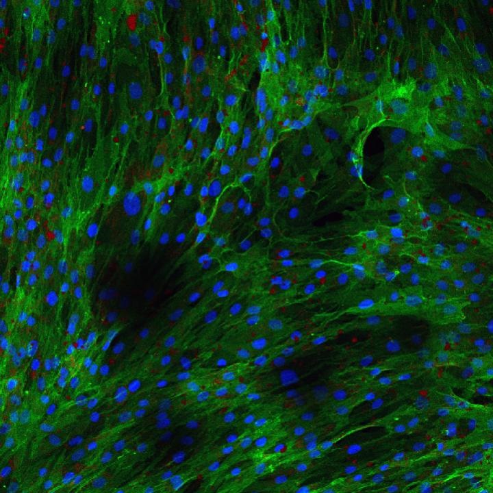 stem cells