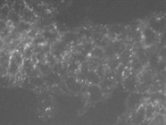 Great DCP1A Antibody for P-Body Staining