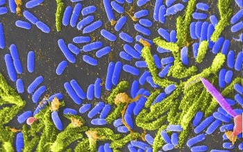 cholera