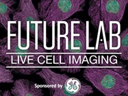 Complimentary Infographic: Tips and Trends for Live Cell Imaging