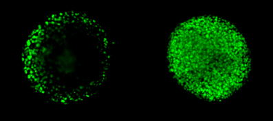 NCI-H2170 spheroids labeled with nuclear stain