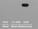 Good Antibody to Detect Human Beta 1 Integrin