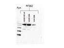 Fyn Antibody for Western Blot