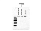 Phospho-YAP Antibody for Western Blot